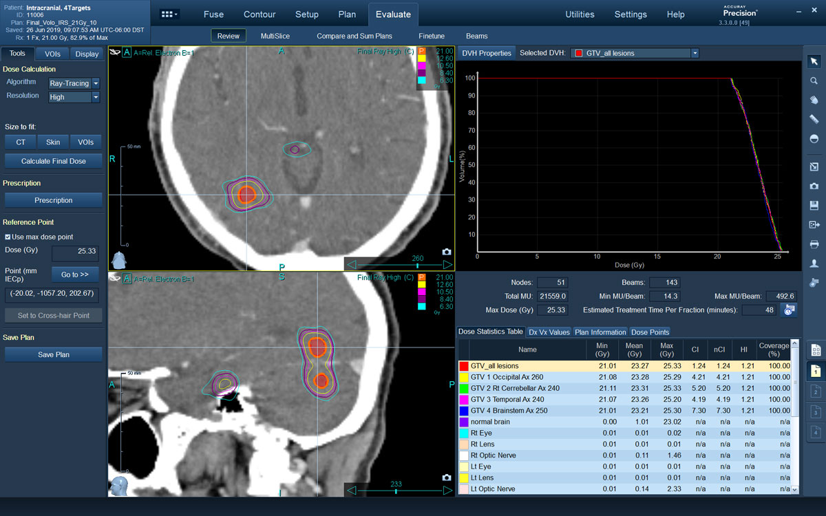 Enhancing and Expanding the CyberKnife® Treatment Platform for the